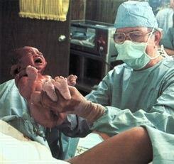 Doğum Fetus, fetus zarları ve plasentanın kadının üreme kanalından dışarı