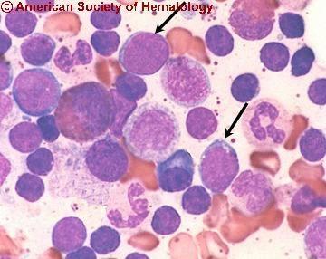 HEMATOGON