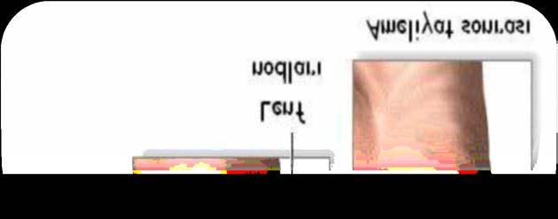 Preoperatif Hemşirelik Bakımı Kol çevre ölçümü dirsek çıkıntısının 7,5 cm altı ve 14 cm altı