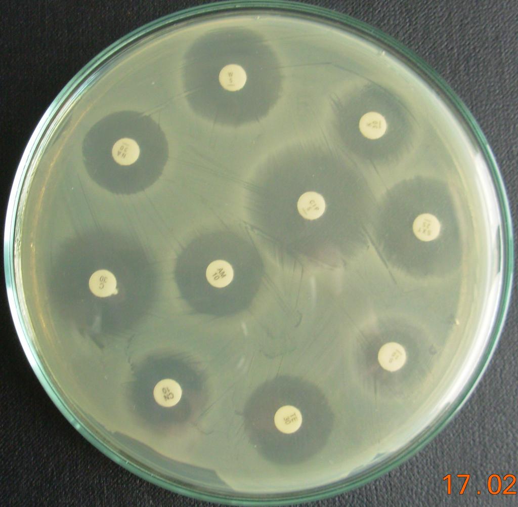 50 Resim 2.6. Mueller Hinton Agar da disk difüzyon tekniğiyle antibiyotik duyarlılık testi 2.2.6. İstatistiksel Analizler Mikrobiyolojik analiz bulgularının istatistiksel değerlendirmesi için Ki Kare kullanıldı.