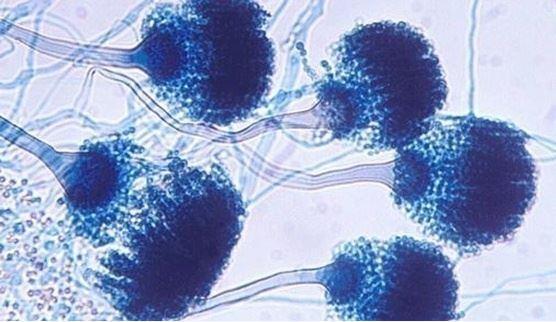 karşı oluşturulmuş JF5 IgG3 monoklonal Ab kullanmakta. Mab Aspergillus spp.