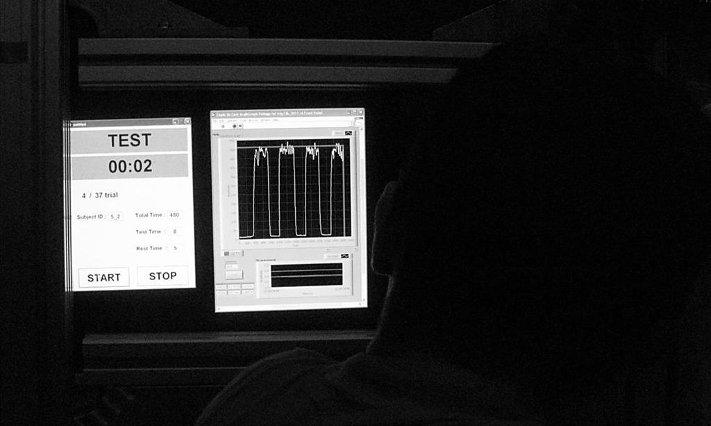 60 Şekil 4.3. Geri bildirim ekranı ve test sayacı. 4.2.4 Elektromiyografi (EMG) Ölçümü Kuvvet verisiyle eş zamanlı olarak BIOPAC MP 150 EMG sistemi (Biopac System Inc.