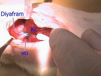 Resim 3. Mini laparotomi sonrası karaciğer (Kc) pamuklu kulak çubuğu ile inferiora çekilir ve inferior vena kavadan (VCI) insülin enjektörüne takılmış 28 G iğne ile heparin verilir. Resim 4.