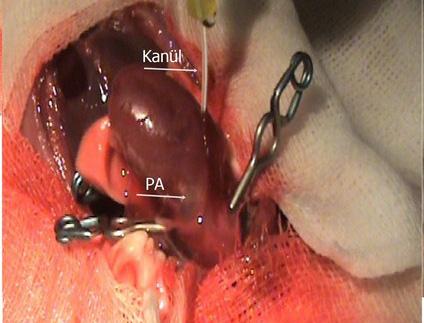 intraket) kalbin sağ ventrikülünden veya trunkus pulmonalis in kökünden yerleştirilir (Resim 7).
