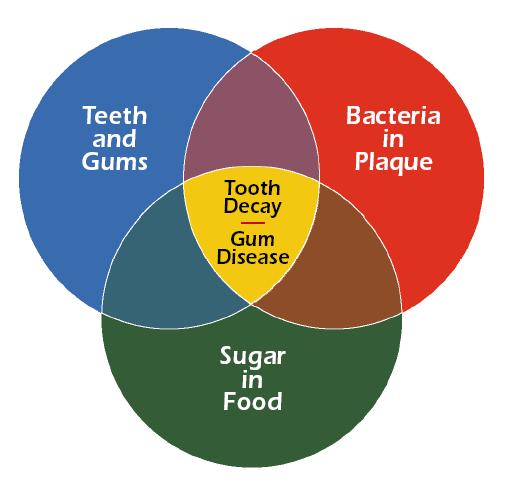 Diş çürüğünü oluşturan faktörler diş ve konakçı (diş eti ) çürük diş ÇÜRÜK -----