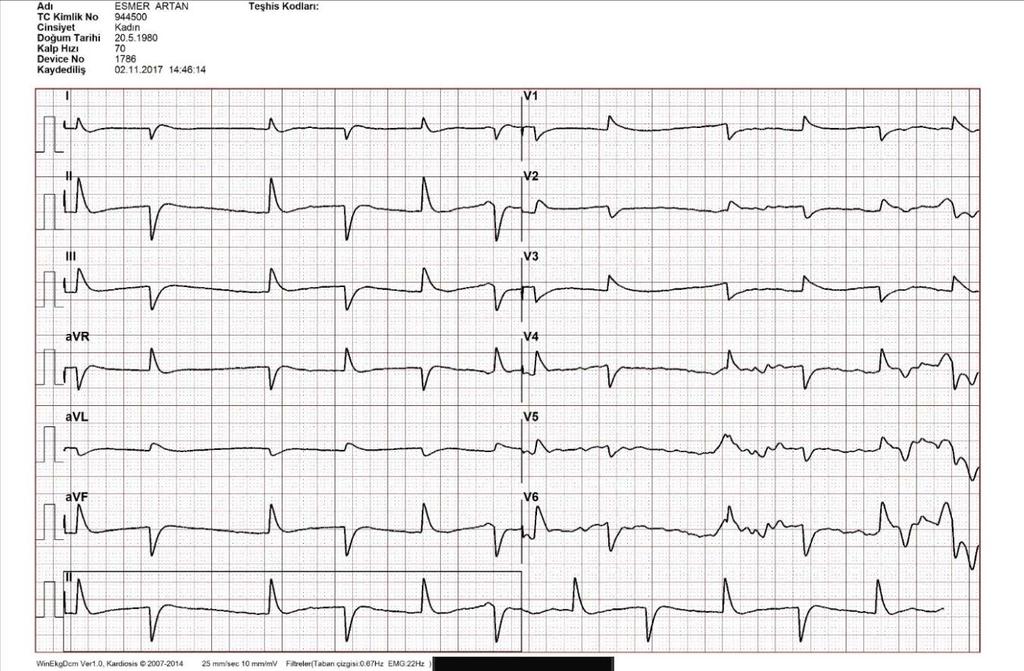 Hastanemizde mevcut kullanımda olan EKG cihazlarımız sistem entegrasyonu tamamlanmıştır.