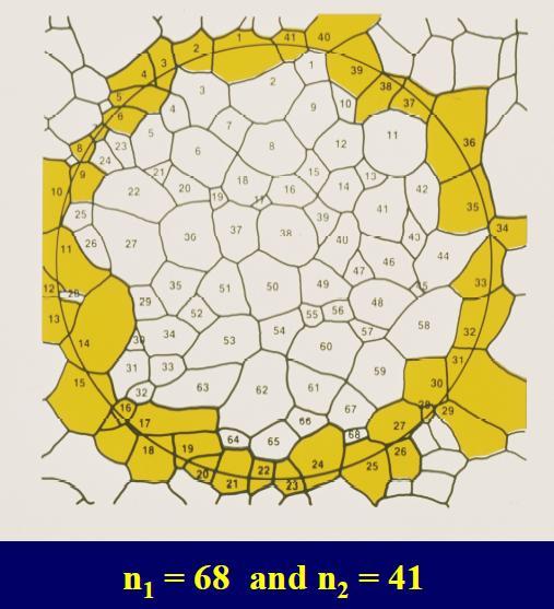 Tane Boyutu Ölçümü Jeffries Planimetric Method ile tane