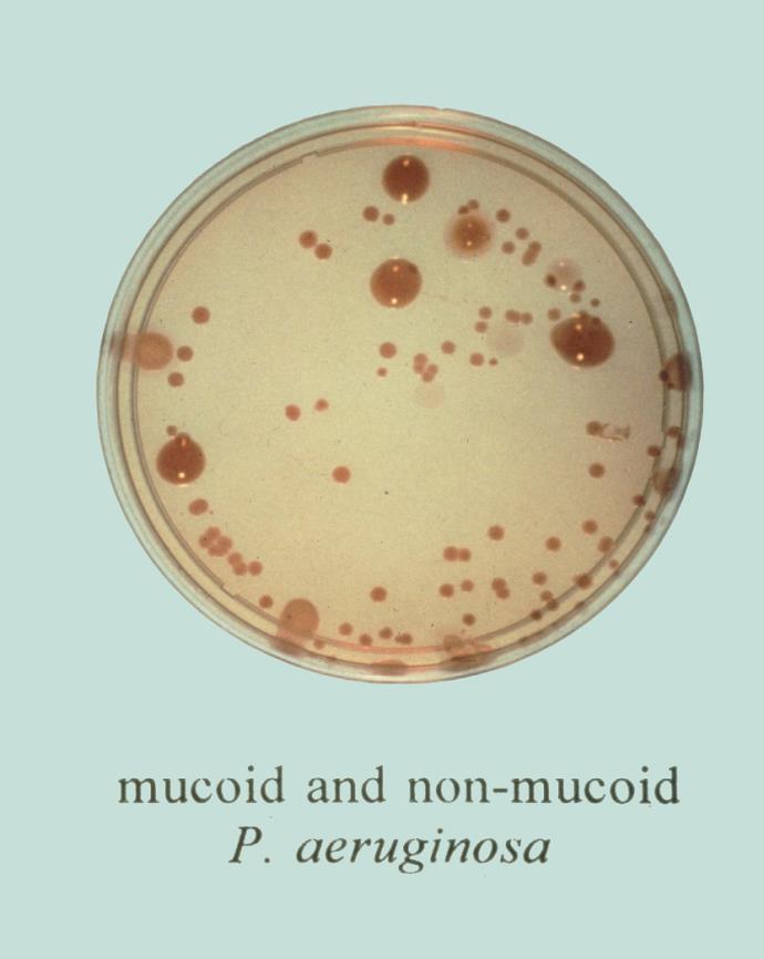 Pseudomonas aeruginosa -Fırsatçı patojen -En sık yoğun bakım