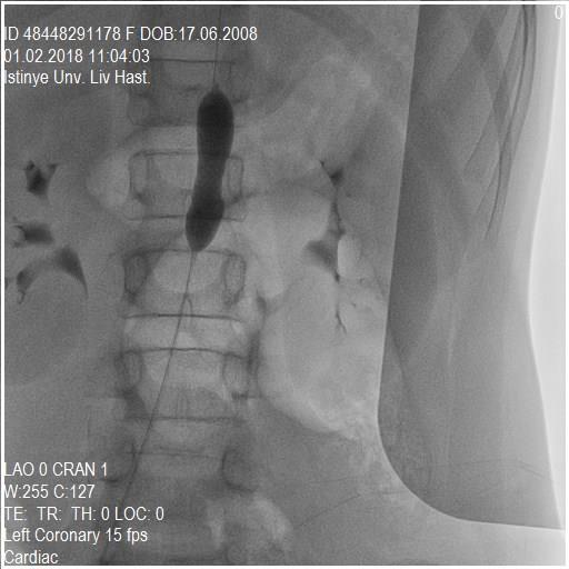 Komplikasyon gelişmedi İşlem öncesi abdominal