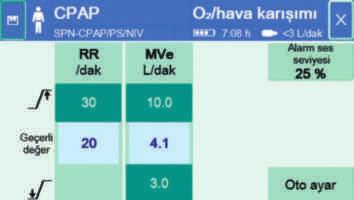 16 OXYLOG VE300 İLE NIV CPAP/PS ile alarm sınırlarının ayarlanması Oxylog VE300'de aşağıdaki alarm seçenekleri mevcuttur: Hava yolu basıncı Paw Solunum hızı RR Dakika hacmi MVe (opsiyonel)