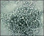 Hepatit B Virusu Hepadnaviridae virus