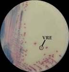 Yöntem Rektal sürüntü kültürleri ChromID VRE agar (biomerieux, Marcy l Etoile,
