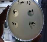 Yöntem Faj duyarlılığı çalışmasında VRE izolatları için biri likit (İntesti bacteriophage) diğeri tablet (Septaphage) olmak üzere iki farklı bakteriyofaj kokteyli kullanılmıştır GSBL E.