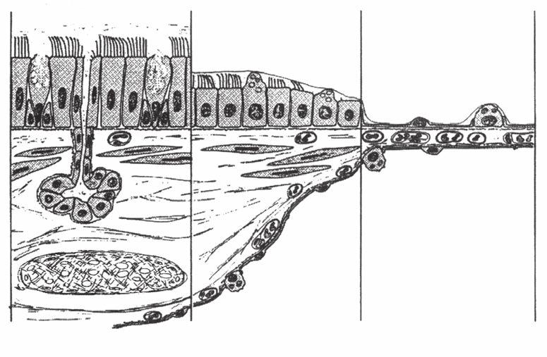 2 SOLUNUM SİSTEMİNİN YAPI VE FONKSİYONU a b c Goblet hücresi Titrek tüylü silendirik epitel hücresi Submukozal gland Kıkırdak yapı Kübik epitel hücresi Yassı epitel hücresi Düz kas hücresi BRONŞ