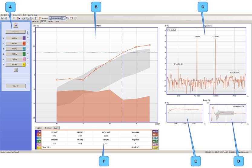 DP I/O A. Kontrol paneli B. Sonuç grafiği: DP grafiği (DP-gram) veya DP I/O (DP I/O) grafiği C. Spektrum (Spectrum) grafiği D. Prop Yerleşimi (Probe Fit) - Zaman grafiği E.