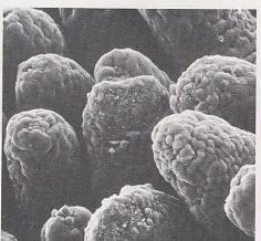 4. VİRÜSLERİN KONAKÇI SAVUNMA SİSTEMİNDEN KORUNMASI 1-Non-sitosidal enfeksiyon(arena, hanta, retro) 2-Hücreden hücreye yayılım(paramyxo) 3-İmmun sistem hücrelerinin yıkımlanması(retro) 4-Non-Permisif