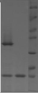 2 1 M (HCAII) Şekil 3.6 Ham ekstraktların SDS PAGE Sonucu (M:Protein Marker, 1: plasmid içermeyen E.coli ye ait ham ekstrakt, 2: Yabani tip HCAII ham ekstrakt) 3.4.2. Yabani ve mutant HCAII nin saflaştırılması IPTG uygulaması ile teşviğin kontrolünden sonra yabani tip ve mutant enzimler BL- 21(DE3) codon plus E.
