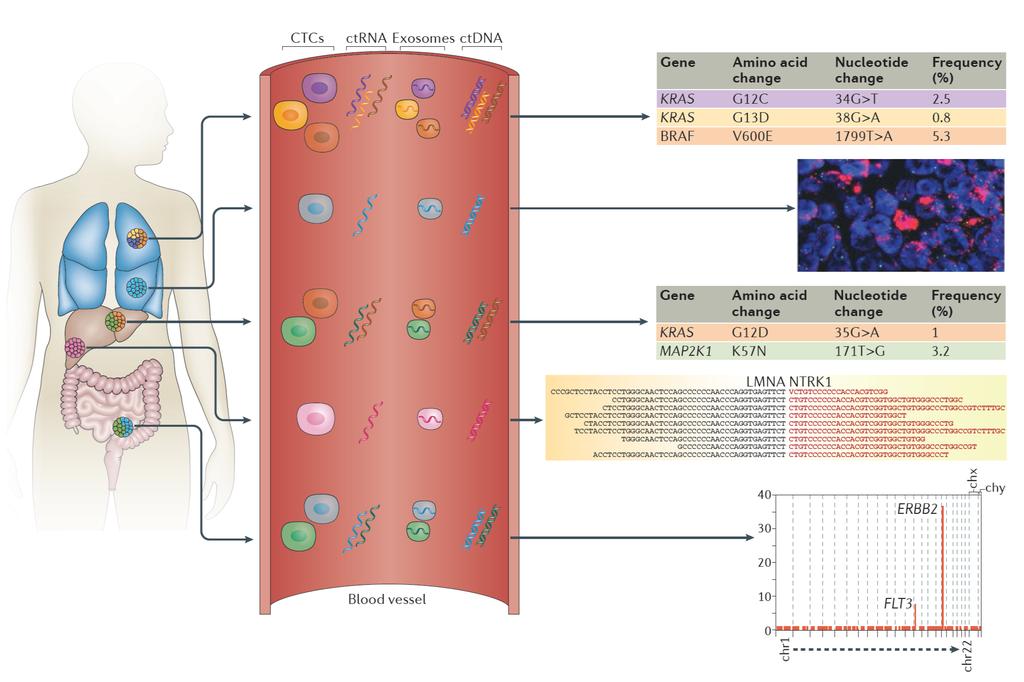 Detection of Genetic Alterations and Genetic Heterogeneity ctcell ctdna ctrna Exosomlar Point mutations Amplyfications & Deletions Translocations