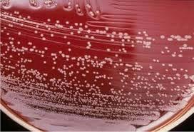 Bordetella avium Gram negatif