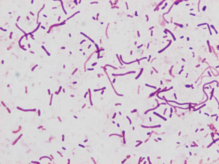 Ornithobacterium rhinotracheale Gram negatif, pleomorfik, sporsuz, hareketsiz, çomak In vitro üremesi yavaş (özellikle üremenin 24.