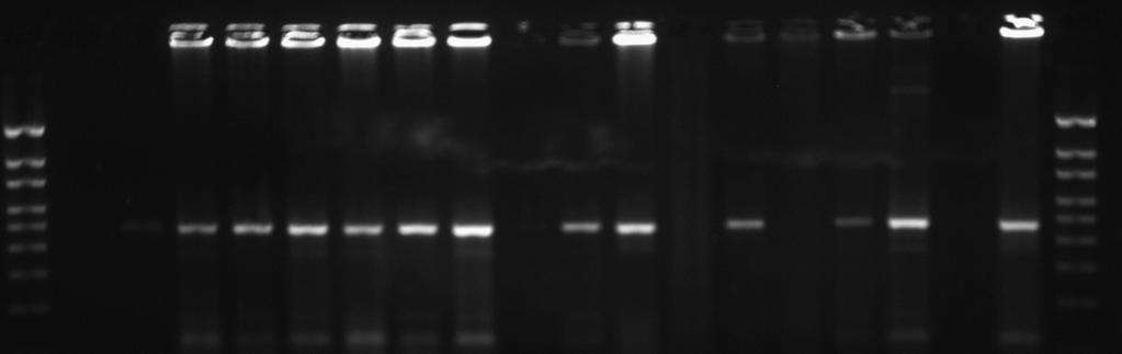 PCR Bulguları M N P 1 2 3 4 5 6 7 8 9 10 11 12 13 14 15 16