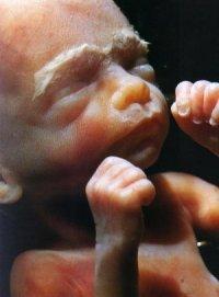 6. Ay DIŞ Lanugo kılları koyulaşır İÇ Sürfaktan salınmaya başlar FETUSUN DIŞARIDA YAŞAM ŞANSI VARDIR! 6. Ayın sonunda fetus işitebilir.