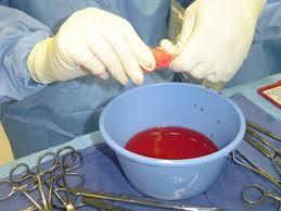 Cerrahi Kan Kaybı Cerrahiye bağlı olarak oluşan kanamayı belirlemenin en etkin yolu, cerrahi ekibin