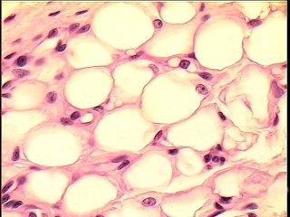 Adipoz doku Doku, yağ hücrelerini biriktirdiğinde adipoz doku (yağsı doku) oluşmaktadır.