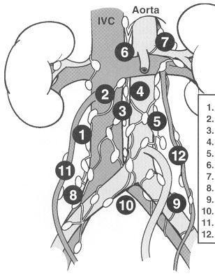 Lenfatik Yayılım Parakaval Prekval İnteraortokaval Preaortik Paraaortik Sağ suprahilar Sol suprahilar Sağ iliak Sol iliak İnteriliak