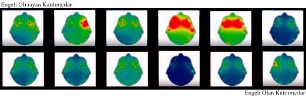 Şekil: 87 ye bakıldığında, fiziksel engeli bulunan katılımcıların arasından rassal olarak seçilen altı kişiden ikisinin alfa dalgası beyin ısı haritası görsellerine göre yüksek aktivite düzeyinde