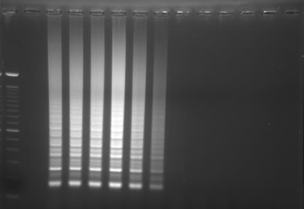 annulata Ankara/D7 DNA sına ait 200 nanogram - 2 femtogram a kadar 10 katlı sulandırmalar. (D); Babesia bovis türüne ait rhoptri protein-1 geninin Iseki ve ark.