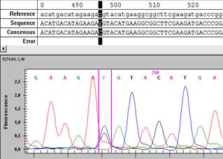 Şekil 15: H31 de saptanan GJB2 geni