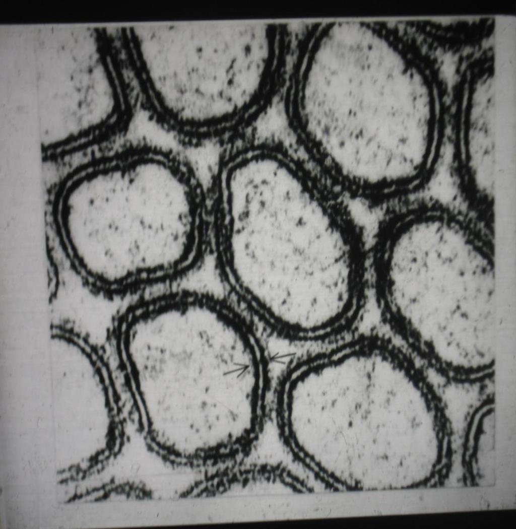 Hücre zarı (plasmalemma) Ünit membran yapısındadır. Ancak, bundaki kolesterol miktarı diğer membranlardan daha fazladır.