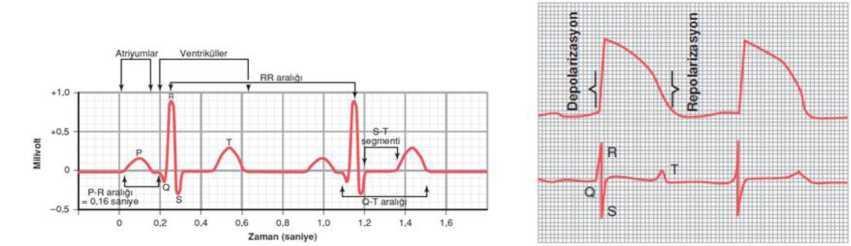 V5 ve V6 derivasyonlarındaki QRS kompleksleri genellikle pozitiftir.