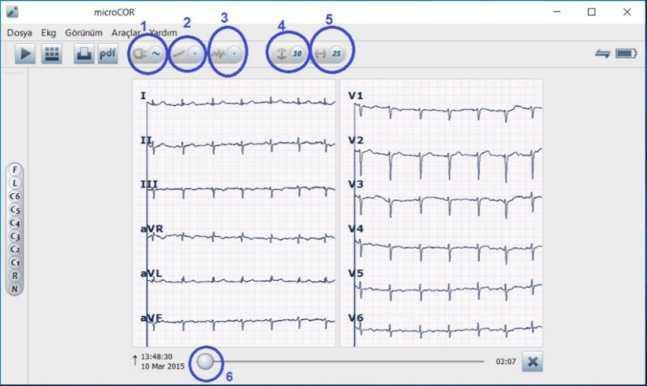 imkanı mevcuttur. Nihon Kohden Cardiofax M1350 K EKG Cihazı Nihon Kohden Cardiofax M 1350 K EKG Cihazı 236 x 120 x 322 mm boyutlarında ve yaklaşık 3,9 kg. ağırlığa sahip olan bir EKG cihazıdır.