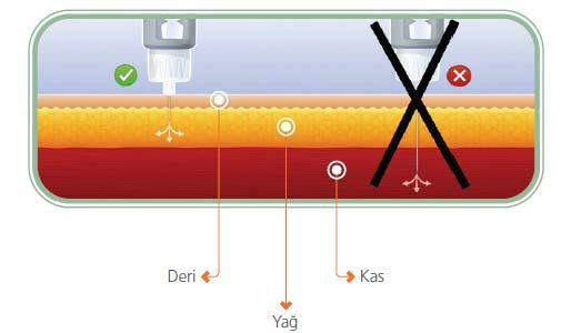 İnsulin yağ doku yerine kas dokuya yapılırsa ne olur?