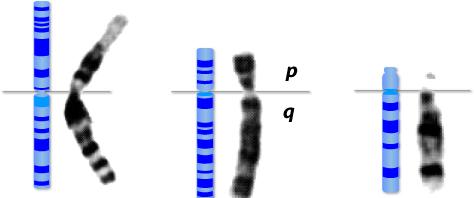 oluşur. İnsan kromozomları, sentromerin bulunduğu yere göre, metasentrik (A), submetasentrik (B) ve akrosentrik (C) adını alırlar (Resim1).