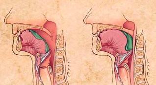 Oral faz; istemli nöral kontrol ile yapılır (81). Kraniyal V, VII ve XII. sinirler bu fazda önemlidir (37).