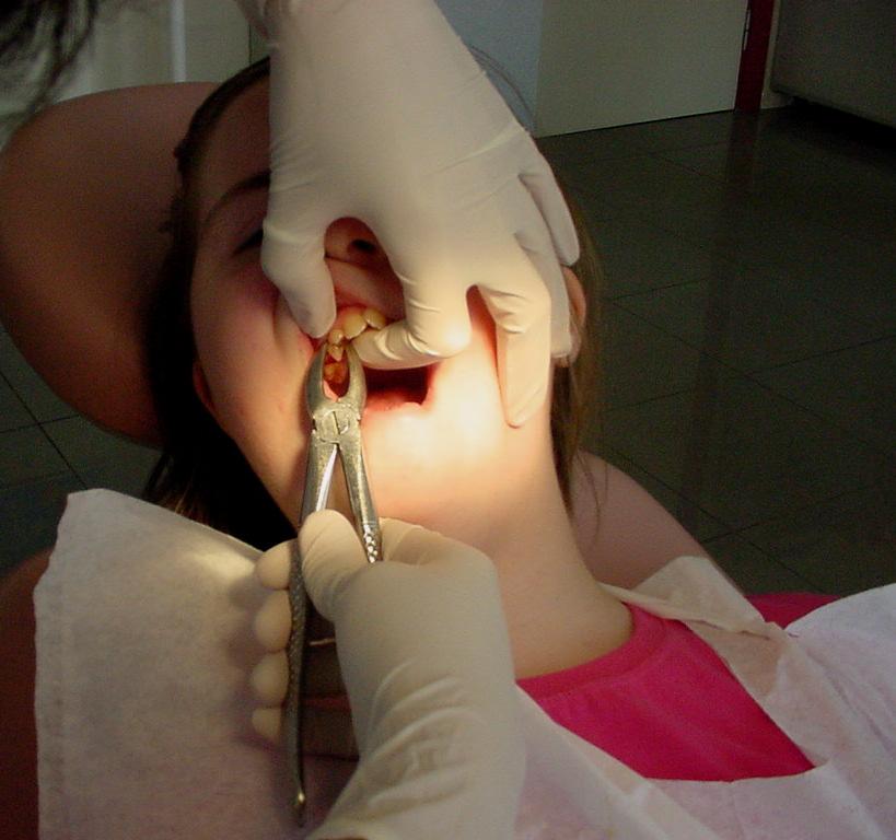 Resim 30-31: Down sendromlu hastaların diş