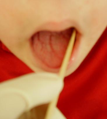 13. Hastanın dudakları ile dişleri arasındaki boşluğa