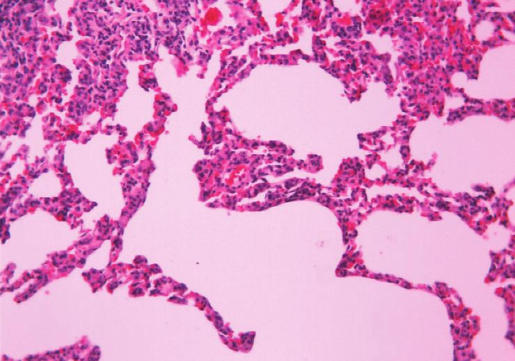 Ayrıca bronşiollerde yer yer epitel hücre dökülmeleri, pulmoner intersisyumda hemosiderin yüklü makrofajlar ve hafif kanama alanları izleniyordu (Şekil 4).