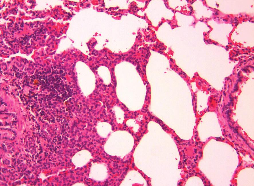 parankimal fibrozis ve alveolar septum kalınlaşması bulgularının her biri 1 er denekte tek bir alanda görülmüştür) nadir alanlarda hafif konjesyon (3 denekte, 1 er alanda