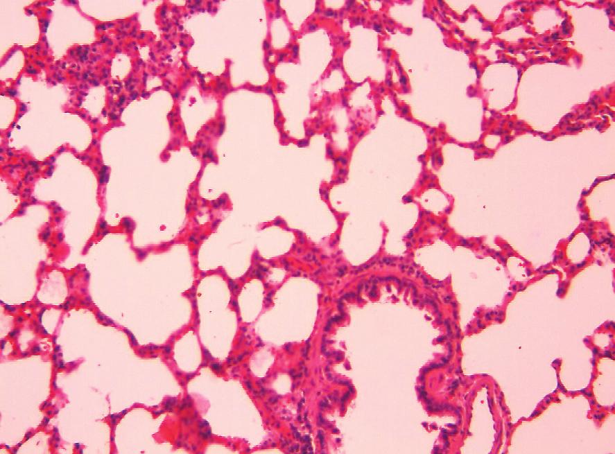 Kurufl M. ve ark. (p=0.015), peribronşial infiltrasyon (p=0.010) ve alveolar septum kalınlaşması (p=0.021) açısından karşılaştırdığımızda istatistiksel olarak anlamlı fark bulduk (p<0.