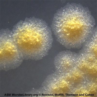 Aktinomisetler mikroskobik görünümde toz, pudramsı yapıları
