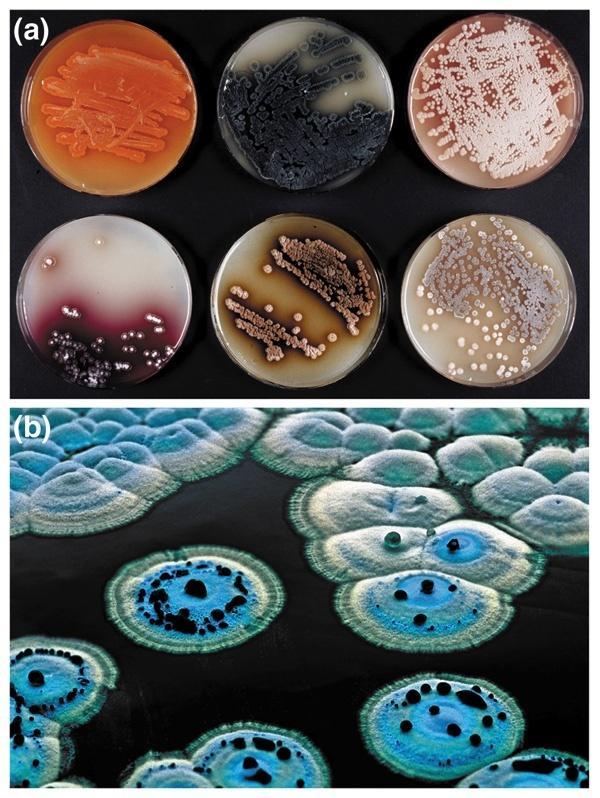 AKTİNOMİSETLERİN EN ÖNEMLİSİ OLAN Streptomyces cinsine ait