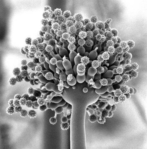 ASPERGILLUS