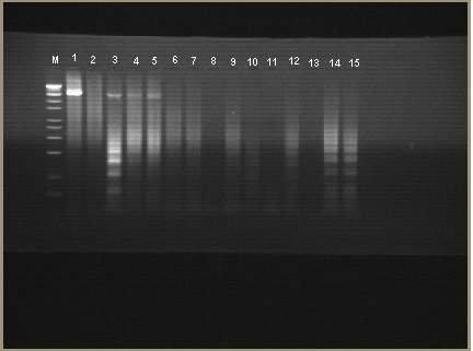Şekil 4.33. Alternatif Konukçu Bitkilerde P1-P7 Universal Primer Seti ile 16S-23S rdna PCR elektroforez sonuçları. M: Marker 1. kuyu: Pozitif Kontrol 2. kuyu: Negatif Kontrol 3.