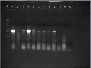 86 Şekil 4.34. Alternatif Konukçu Bitkilerde P1-P6 Universal Primer Seti ile 16S-23S rdna PCR elektroforez sonuçları. M: Marker 1. kuyu: Pozitif Kontrol, 2. kuyu: Negatif Kontrol, 3.