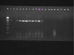 75 Şekil 4.21. Domates Yapraklarının P1-P6 Universal Primer Seti ile 16S-23S rdna PCR elektroforez sonuçları. M: Marker 1. kuyu: Pozitif Kontrol 2. kuyu: Negatif Kontrol 3-19.