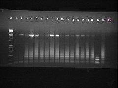 77 Şekil 4.23. Domates Çiçeklerinin P1-P6 Universal Primer Seti ile 16S-23S rdna PCR elektroforez sonuçları. M: Marker 1. kuyu: Negatif Kontrol 2. kuyu: Pozitif Kontrol 3-19.